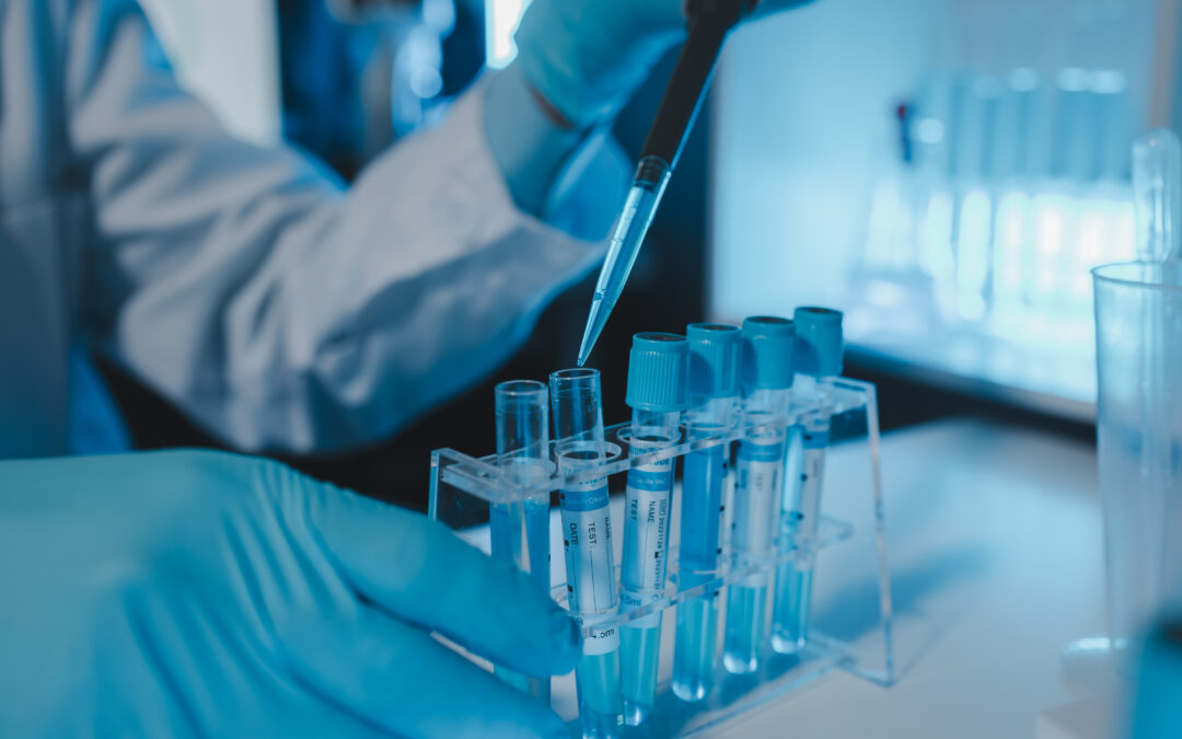 Consejos Esenciales para Seleccionar Azul de Metileno en Investigación de Laboratorio